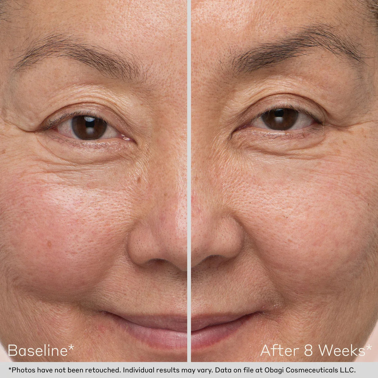 Nu-Cil™ Eyebrow Boosting Serum