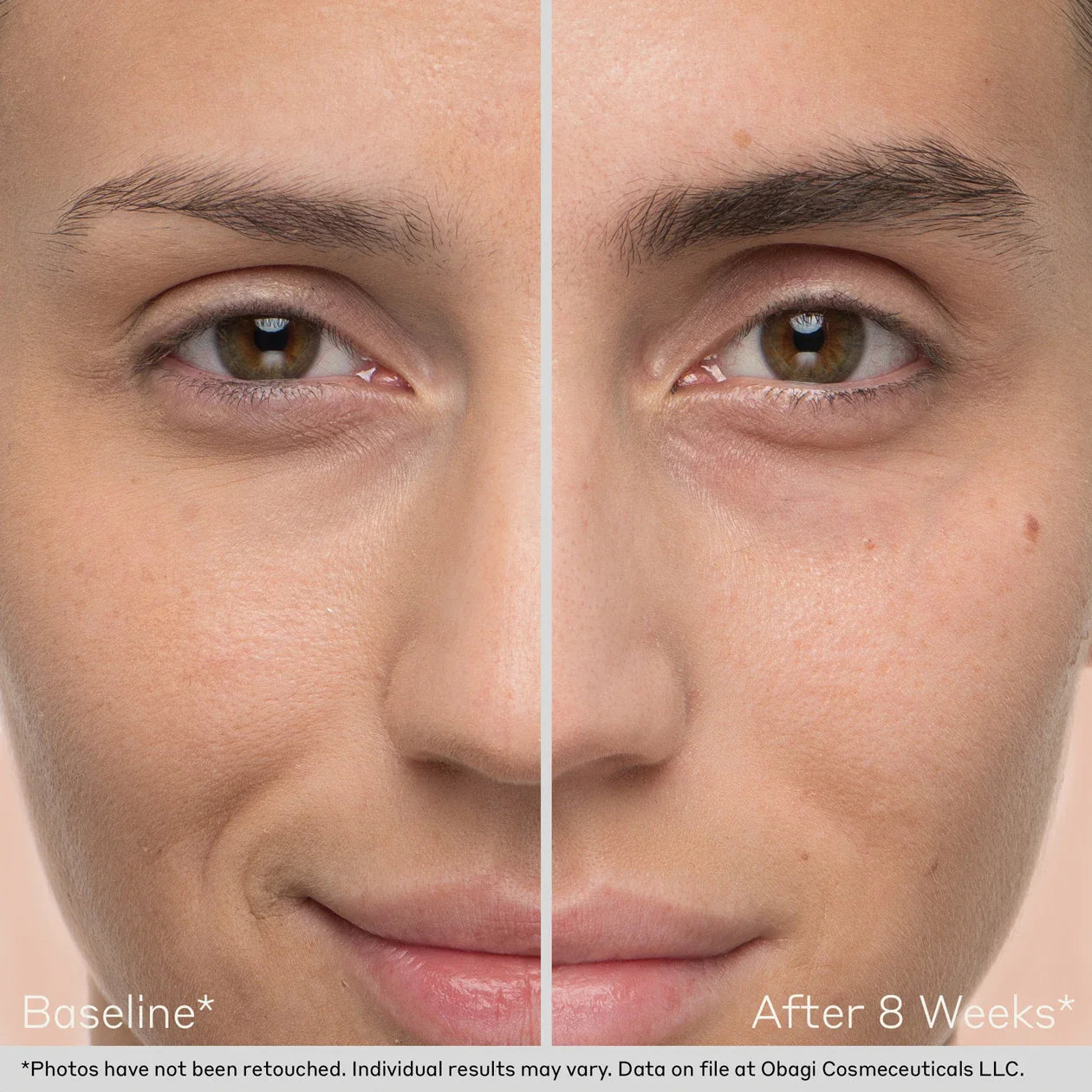 Nu-Cil™ Eyebrow Boosting Serum