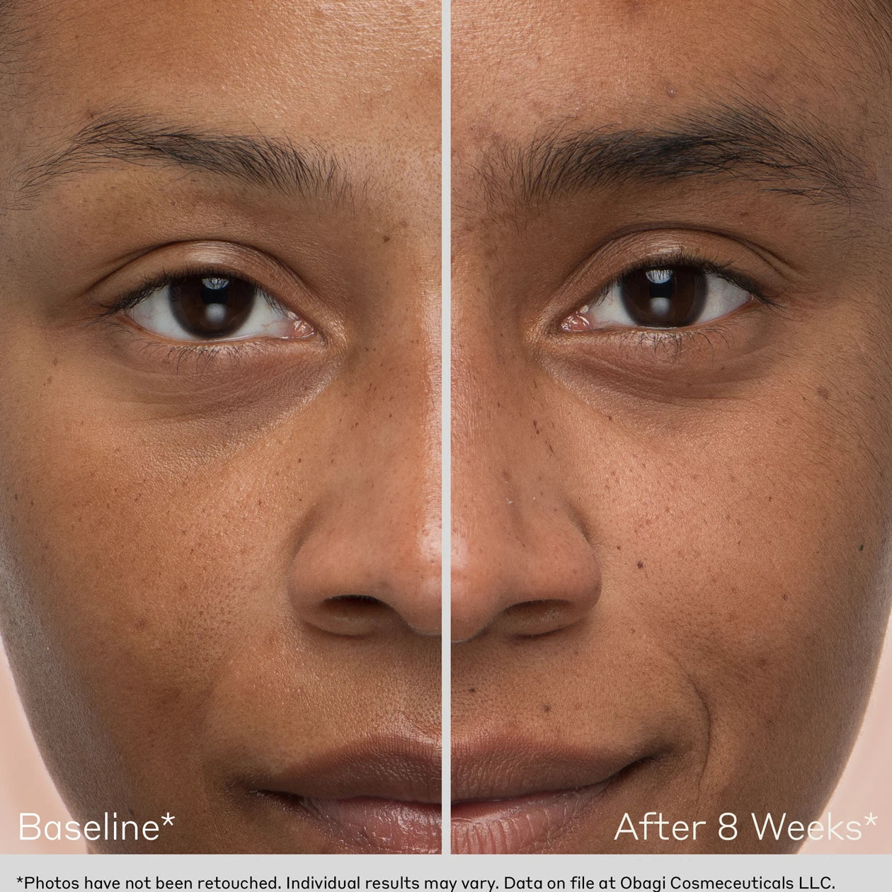 Nu-Cil™ Eyebrow Boosting Serum