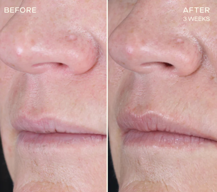 The Lip Plumping and Enhancing Regimen