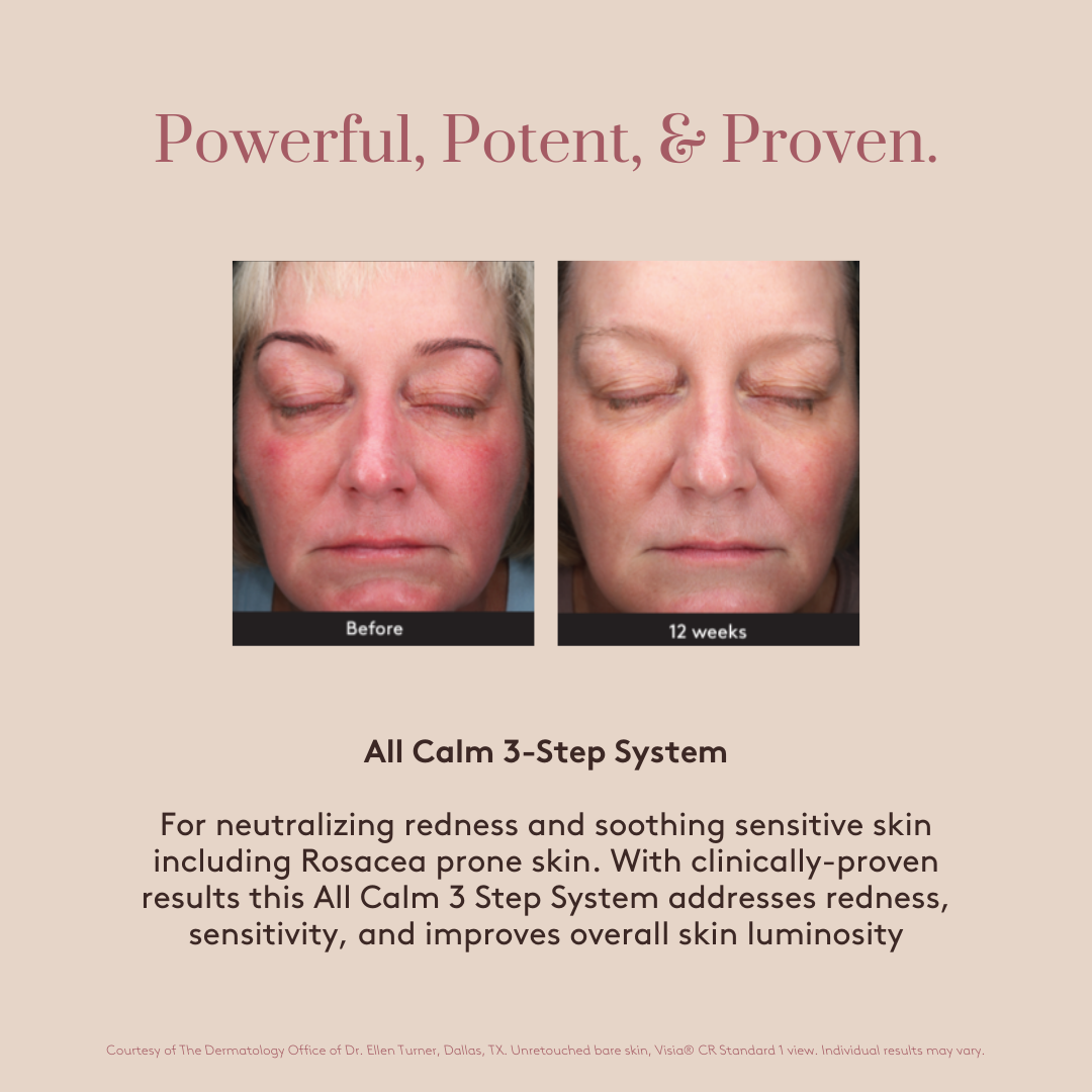 All Calm® Multi-Correction Serum 1 fl oz