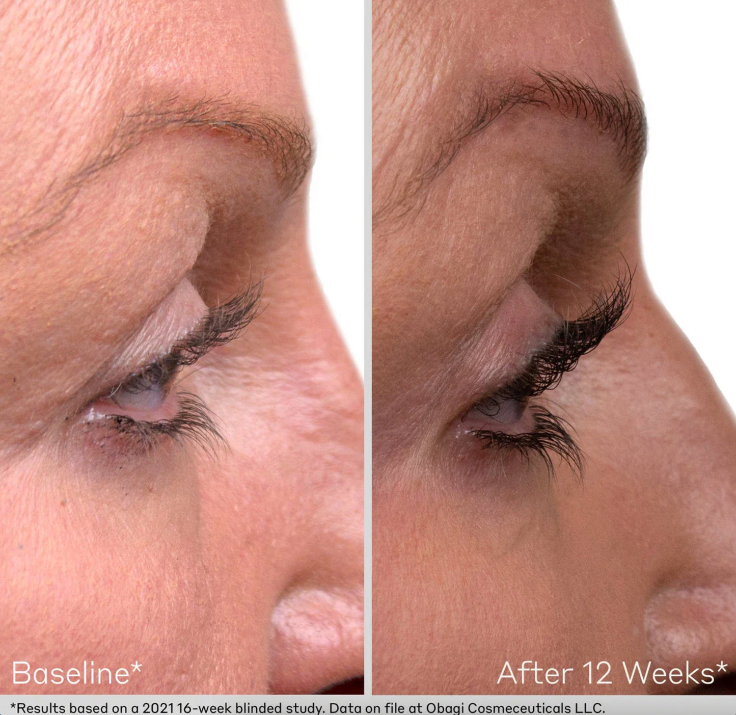 OBAGI® LASH AND BROW SERUM SET