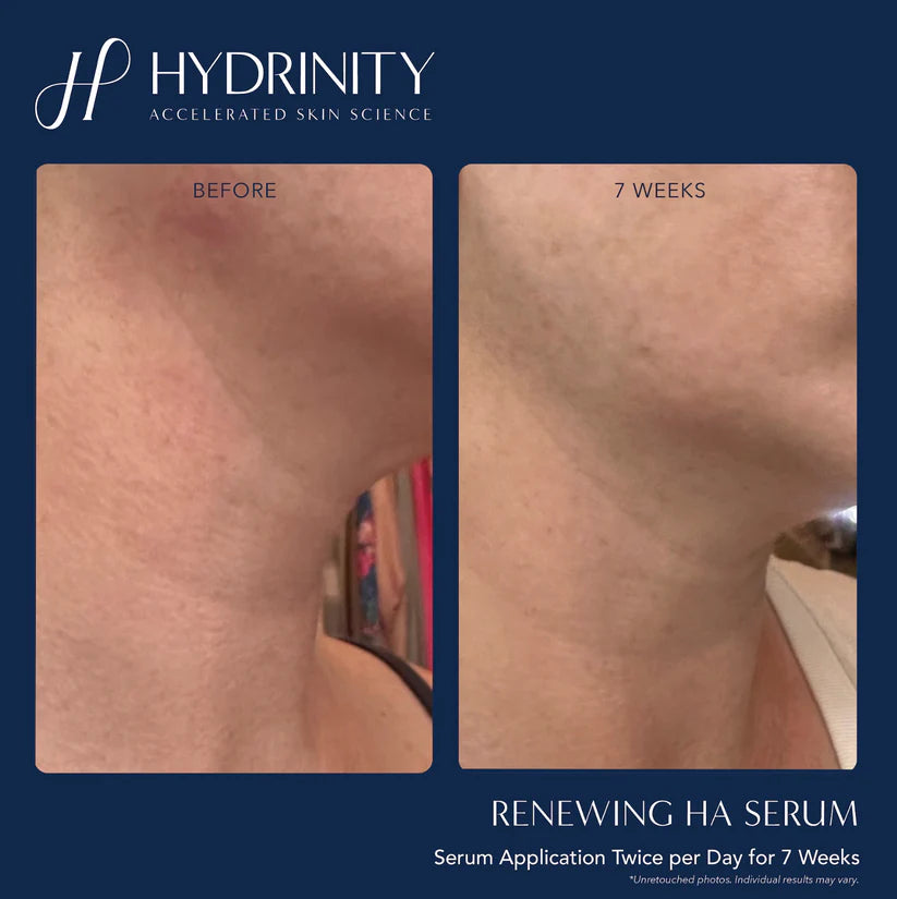 Brightening & Tightening Trifecta