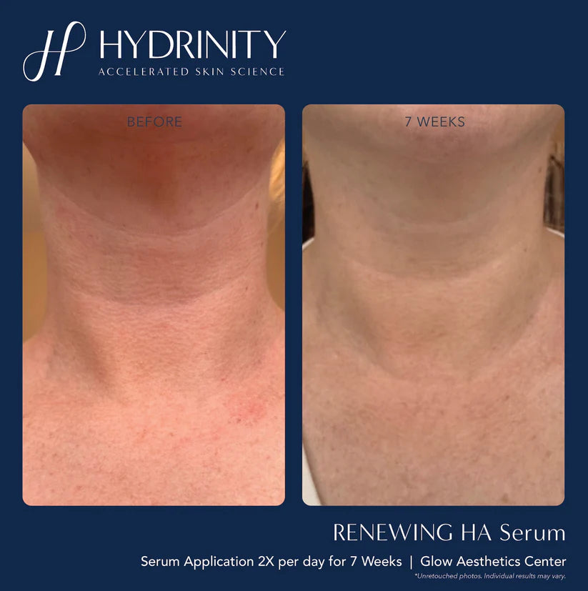 Brightening & Tightening Trifecta