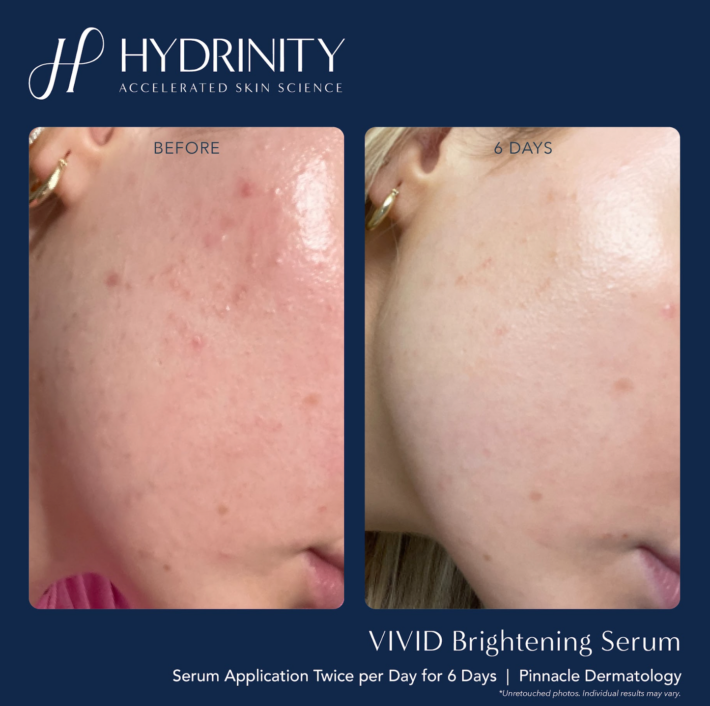 Vivid Brightening Serum