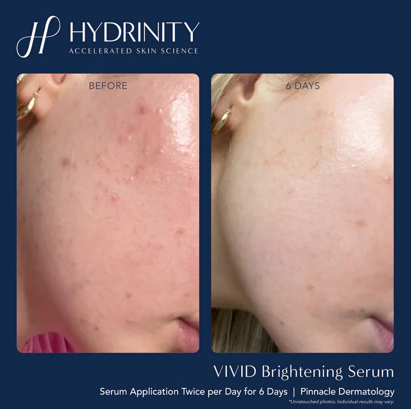 Brightening & Tightening Trifecta