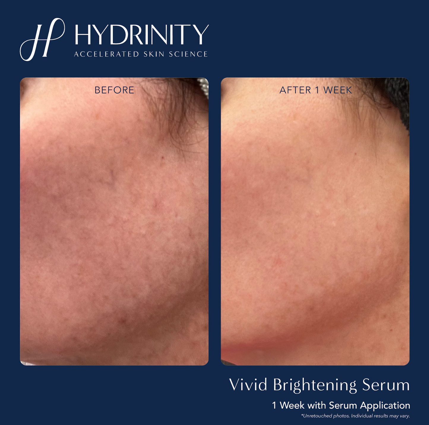 Vivid Brightening Serum