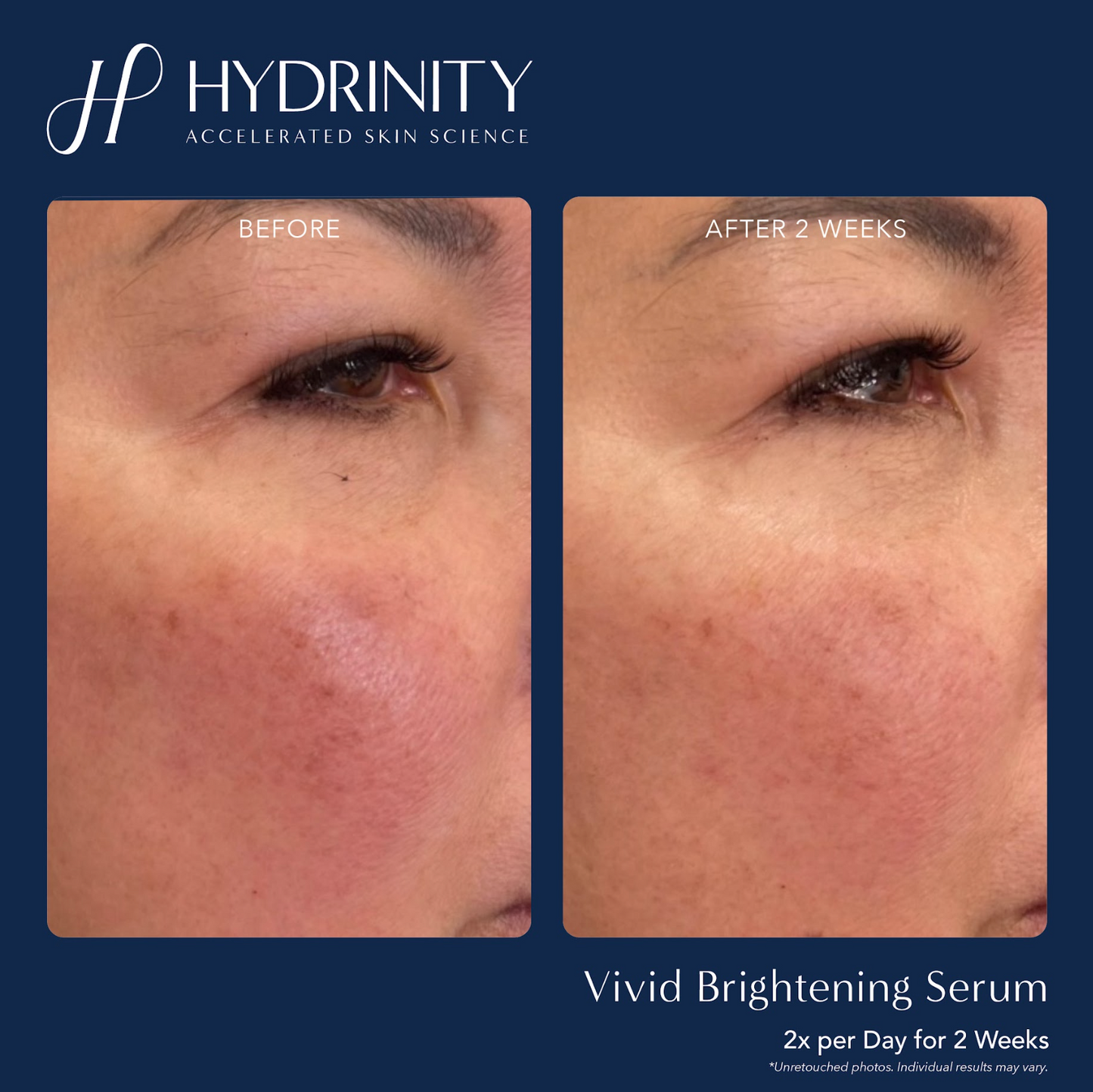 Vivid Brightening Serum