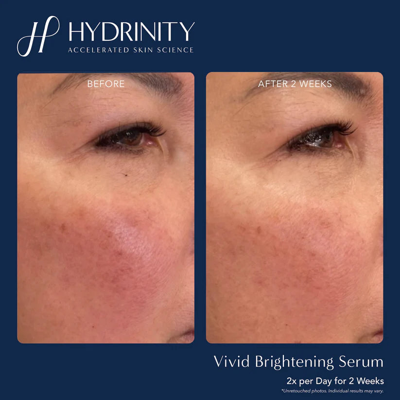 Brightening & Tightening Trifecta