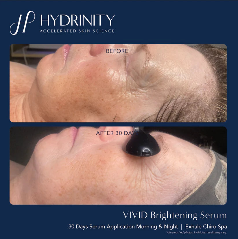 Brightening & Tightening Trifecta