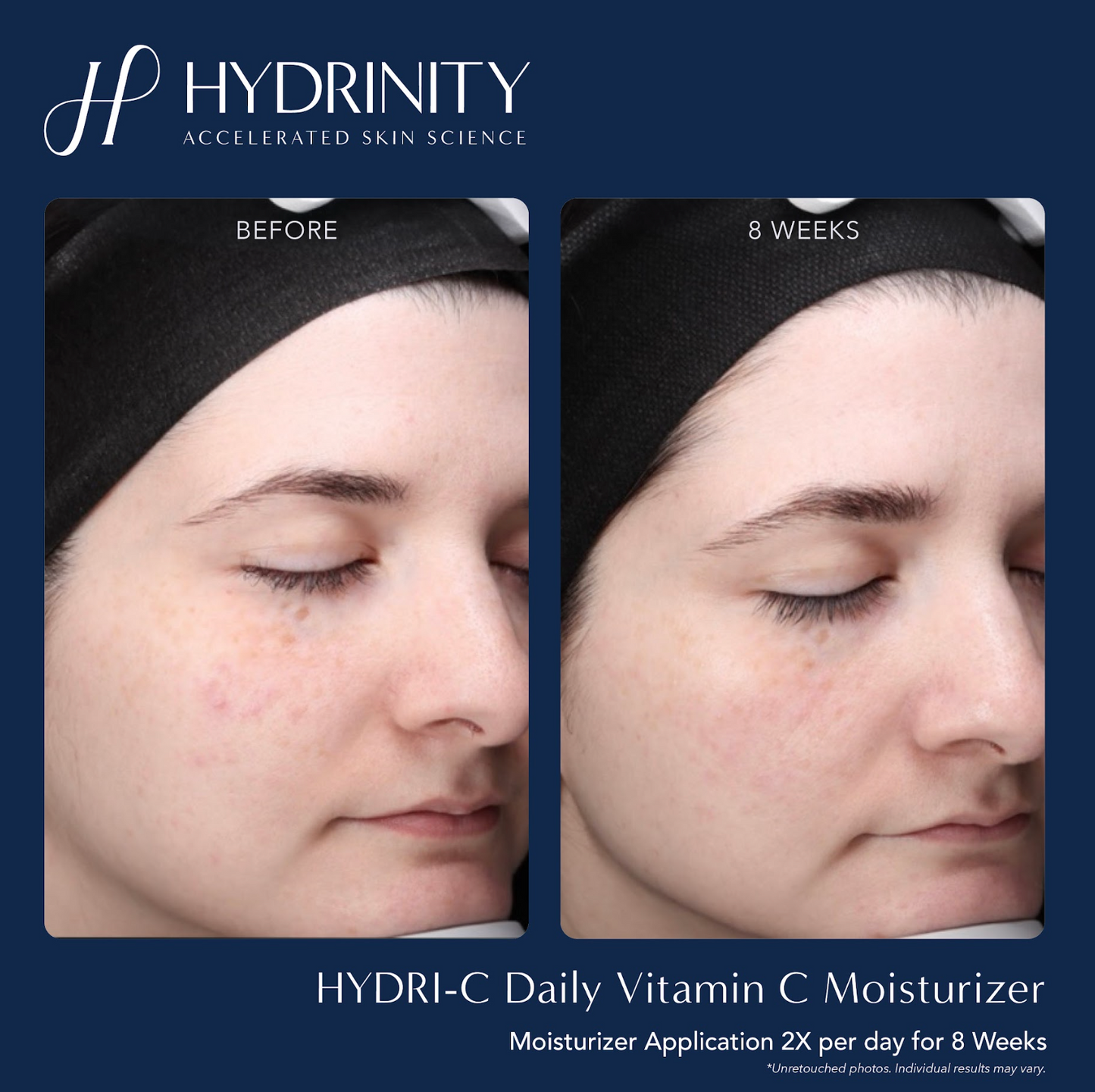 HYDRI-C Daily Vitamin C Moisturizer