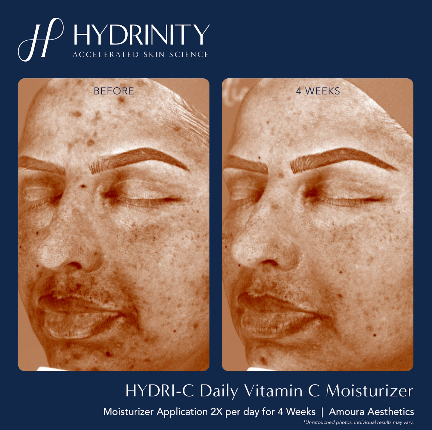 HYDRI-C Daily Vitamin C Moisturizer