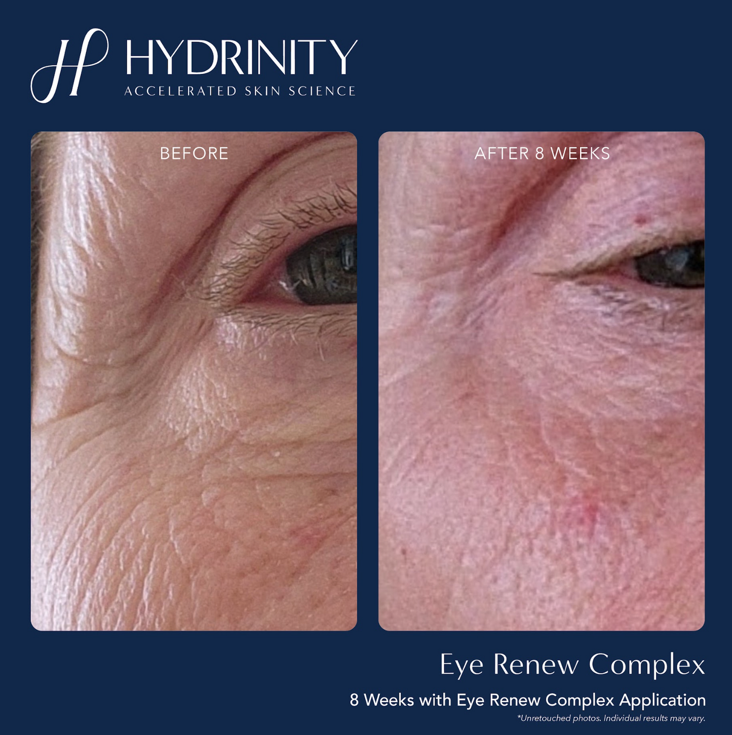 Eye Renewal Complex