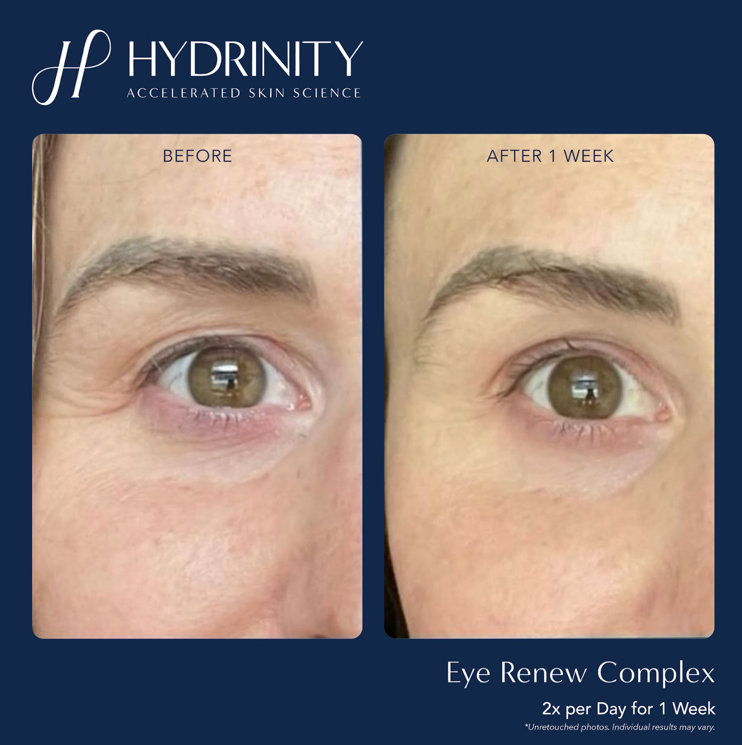 Eye Renewal Complex