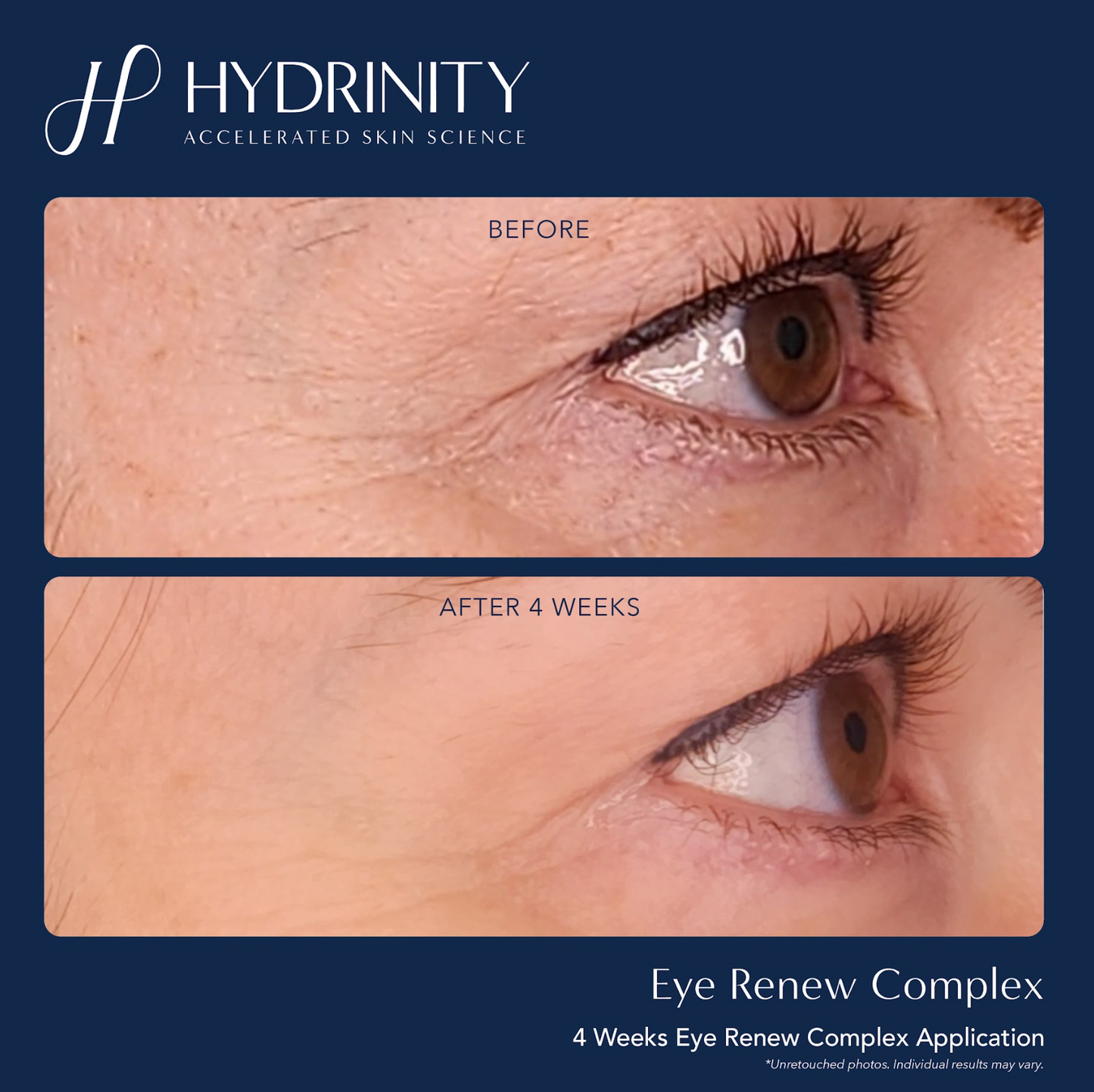 Eye Renewal Complex
