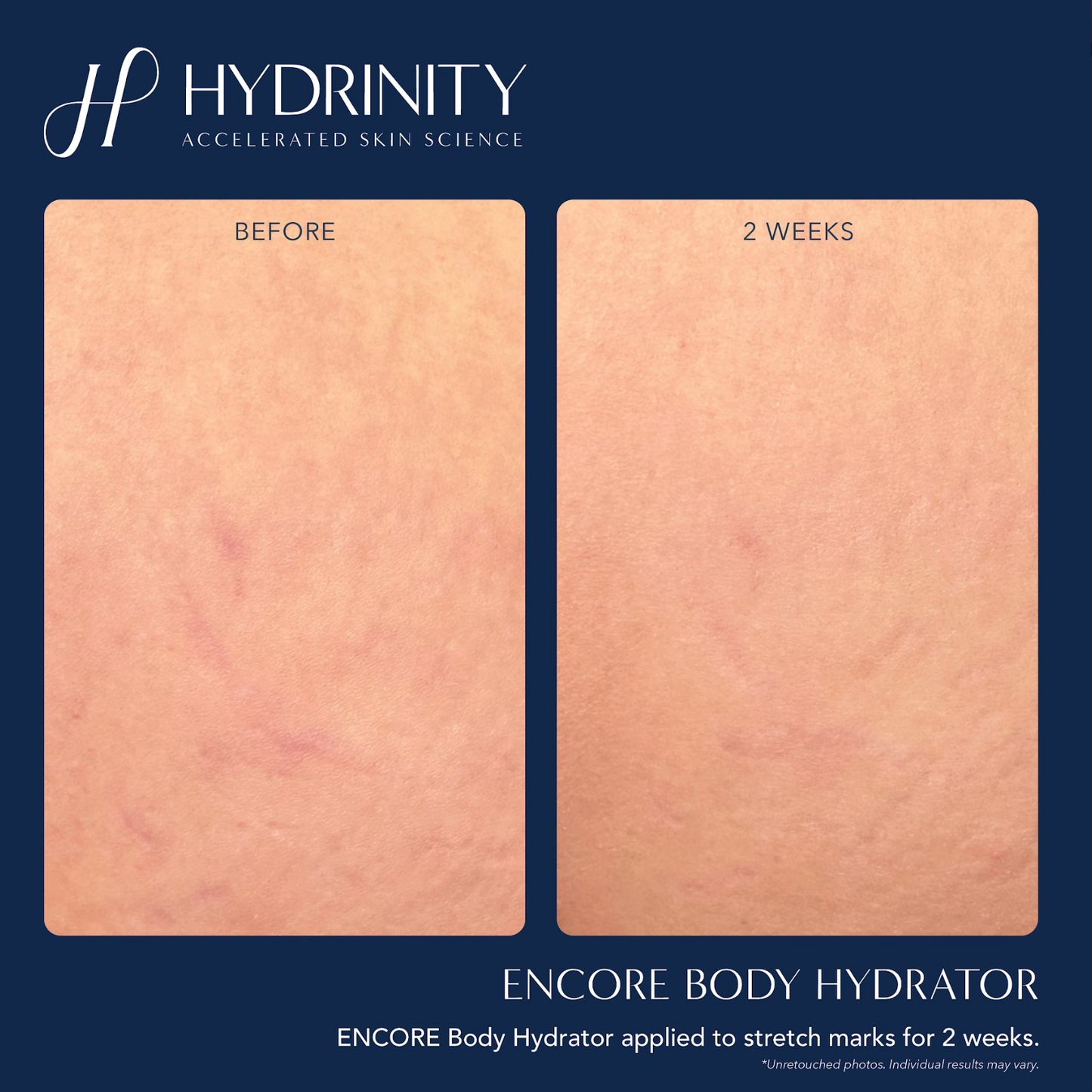 ENCORE Body Hydrator