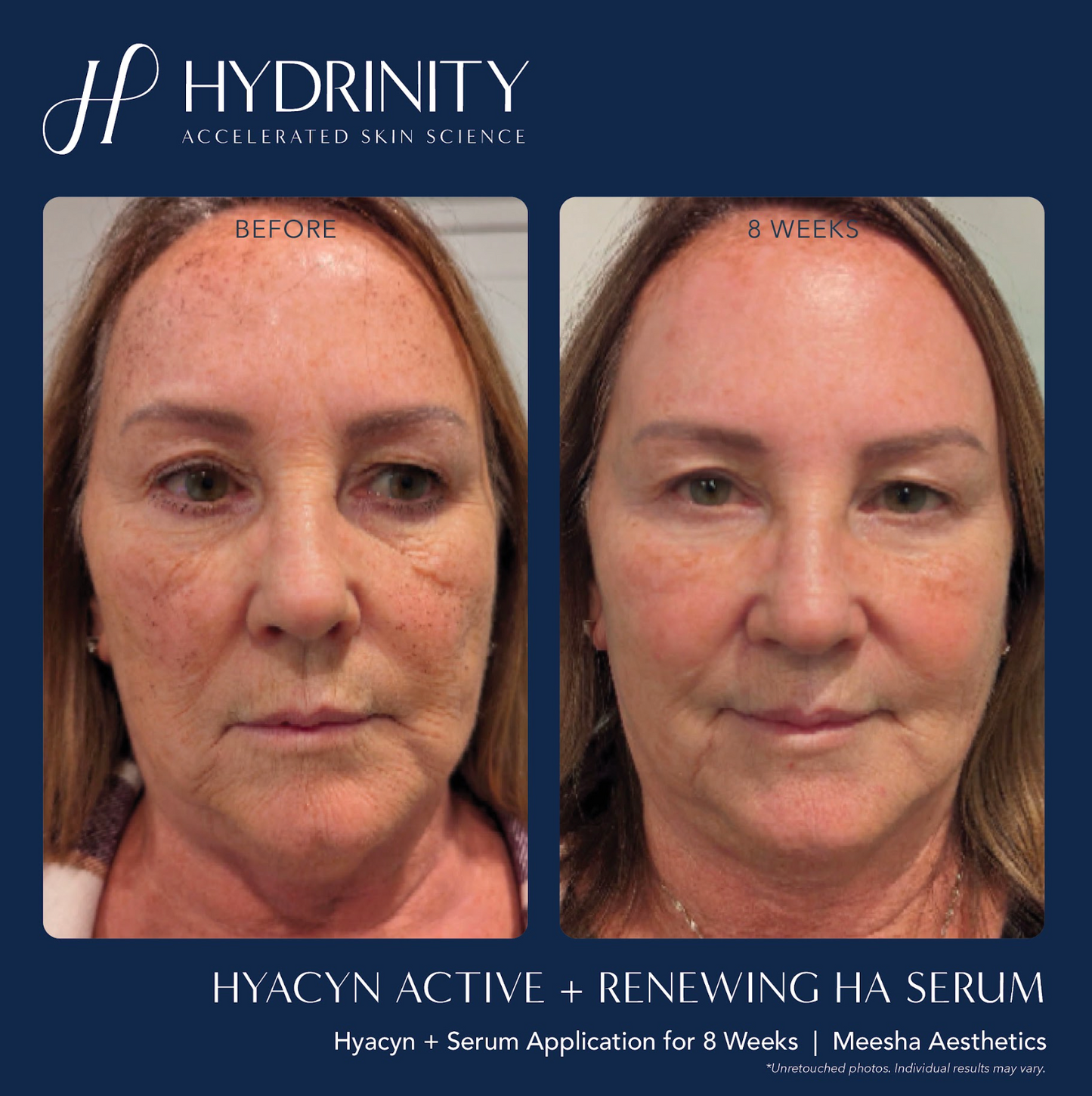 Age Renewal Kit