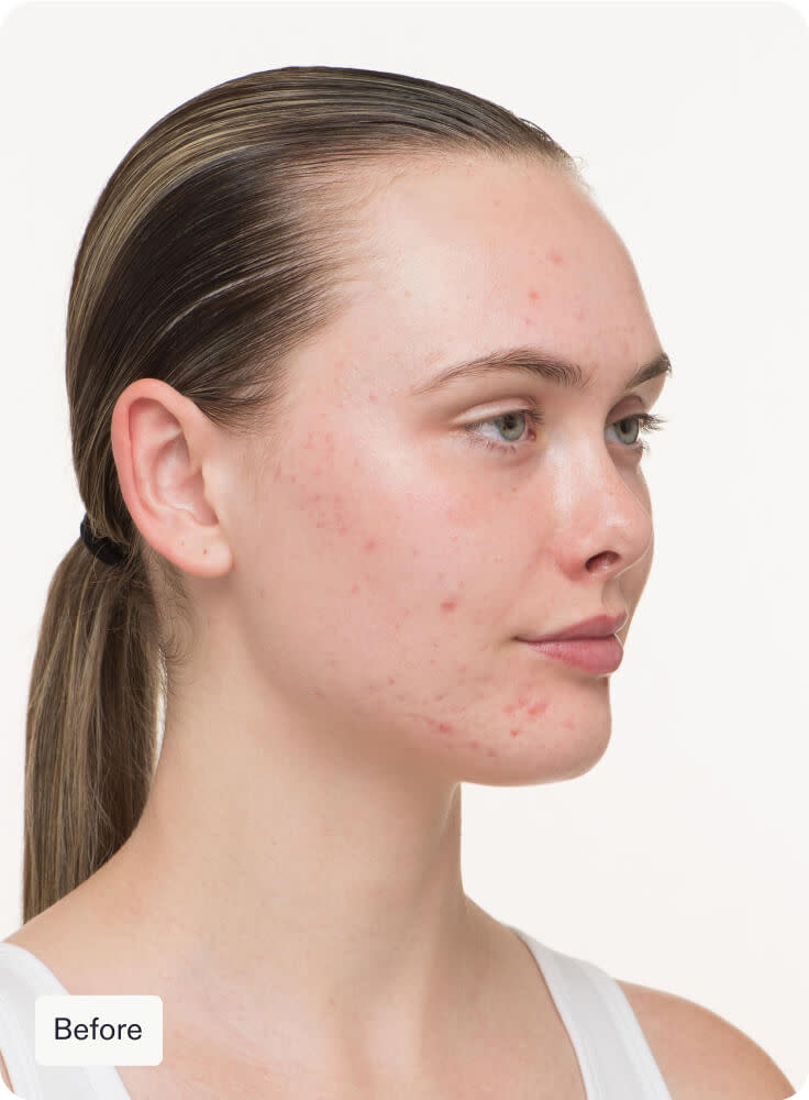 Nutrafol Skin (90 Day Supply)