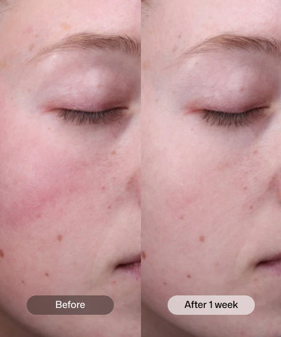 Radiance+ Resurfacing Serum 1 oz & Sleep Mask