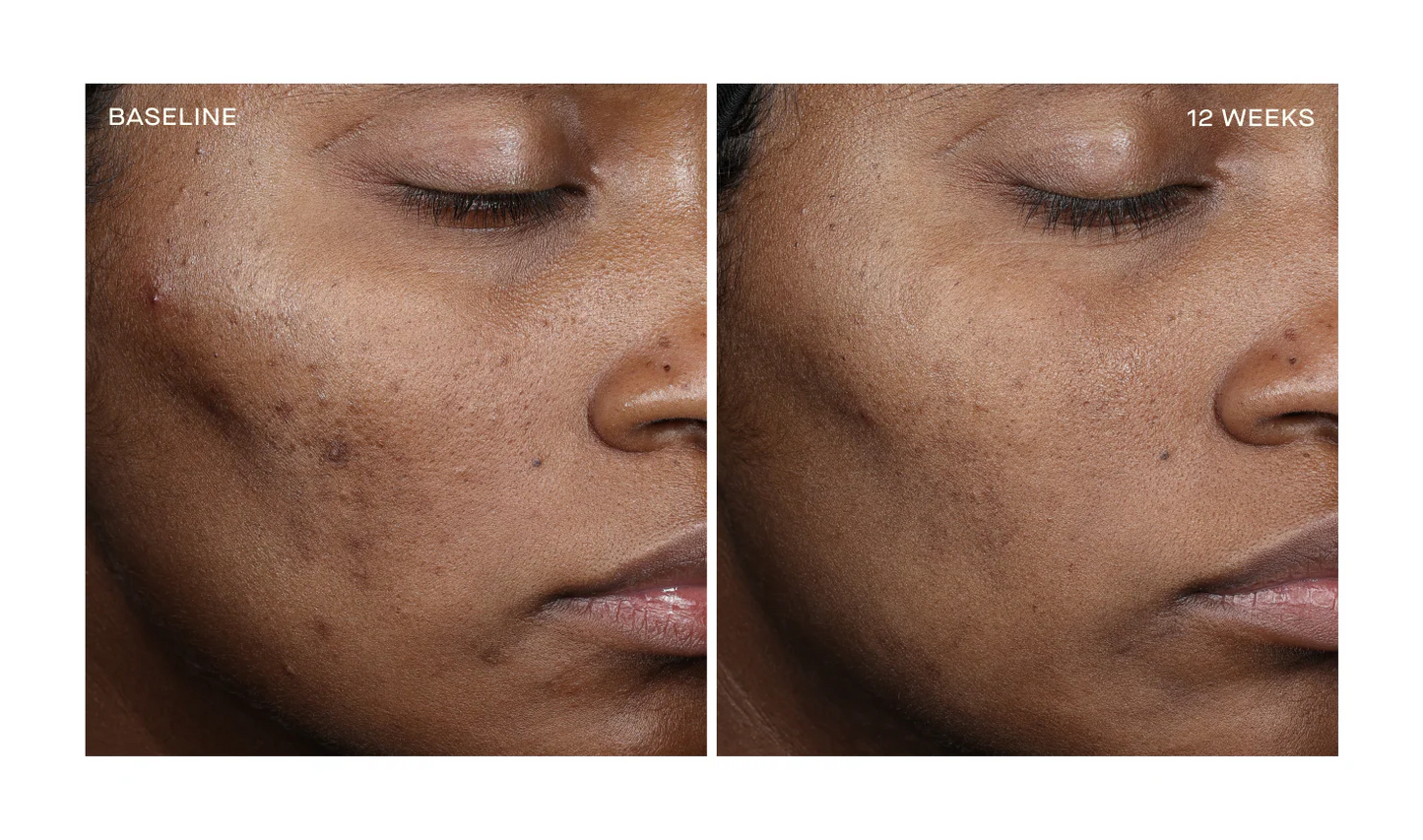NEW Complexion Brightening Serum