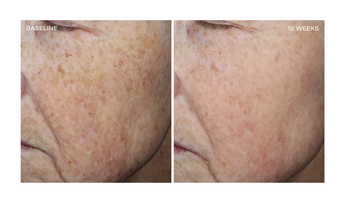 NEW Complexion Brightening Serum