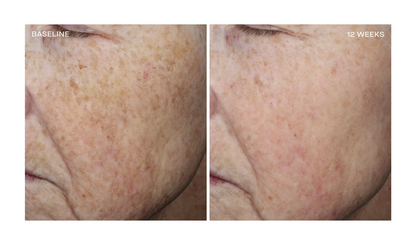 NEW Complexion Brightening Serum