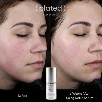 DAILY Serum 1 fl oz