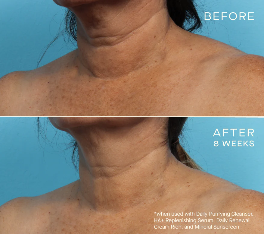 NEW Advanced Regenerative Serum 30mL
