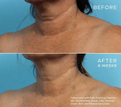 NEW Advanced Regenerative Serum 30mL