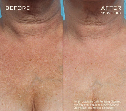 NEW Advanced Regenerative Serum 30mL