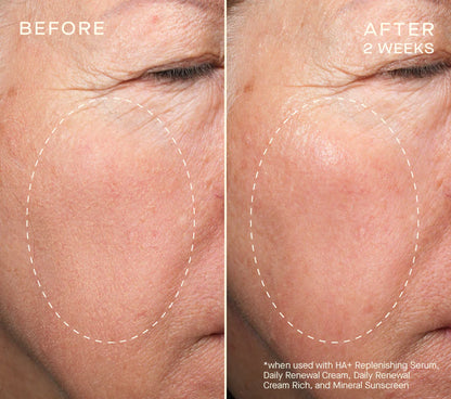 NEW Advanced Regenerative Serum 30mL