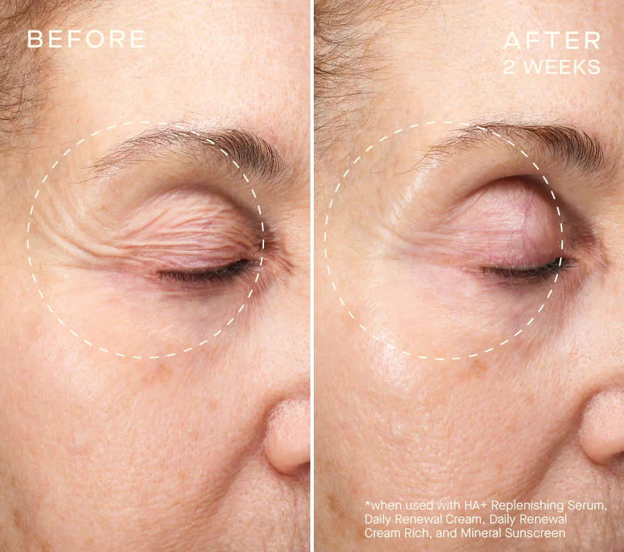 NEW Advanced Regenerative Serum 30mL