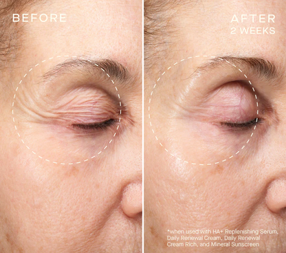 NEW Advanced Regenerative Serum 30mL