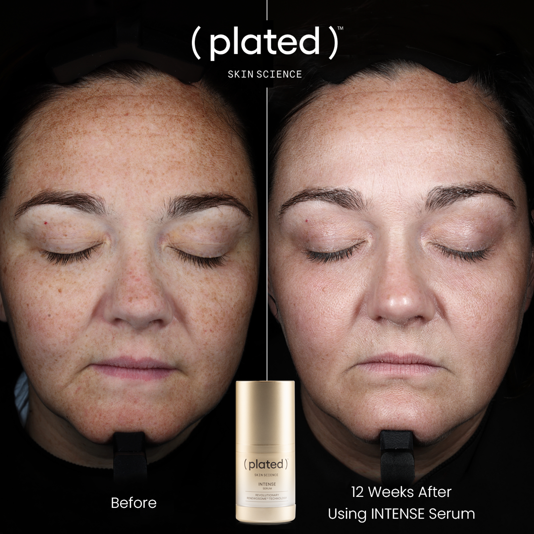 Intense Serum .5 fl oz