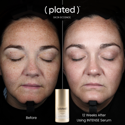 Intense Serum .5 fl oz