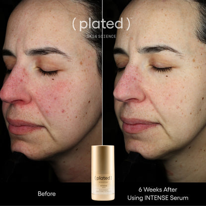 Intense Serum .5 fl oz