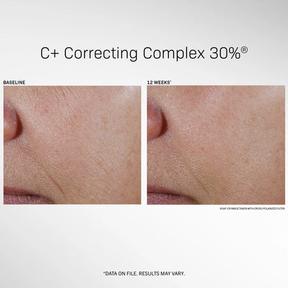 C+ Correcting Complex 30%® 1 fl oz