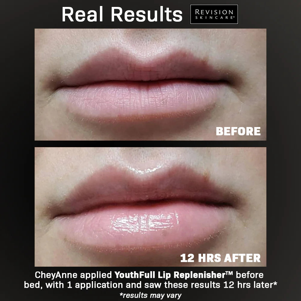 YouthFull Lip Replenisher® 1-Pack