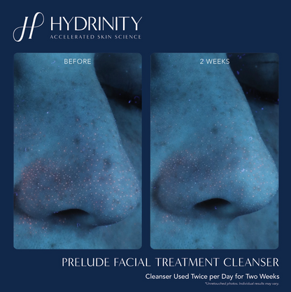 Prelude Facial Treatment Cleanser 6 fl oz