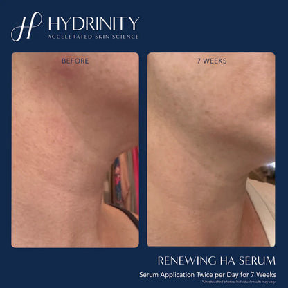 Brightening & Tightening Trifecta