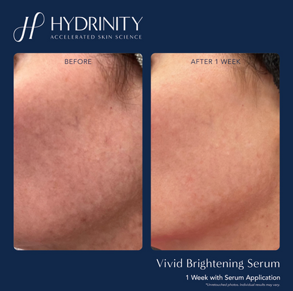 Vivid Brightening Serum