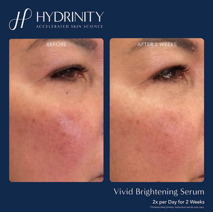 Brightening & Tightening Trifecta