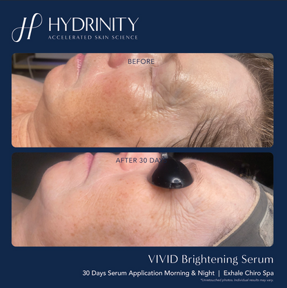 Vivid Brightening Serum