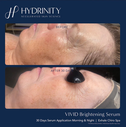 Brightening & Tightening Trifecta