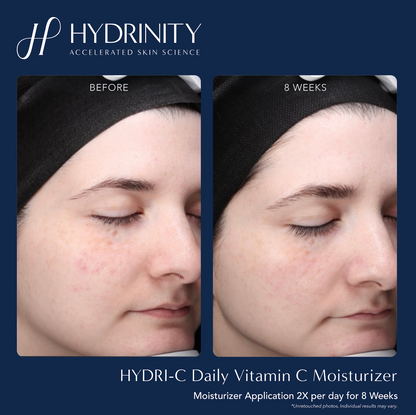 HYDRI-C Daily Vitamin C Moisturizer