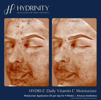 HYDRI-C Daily Vitamin C Moisturizer