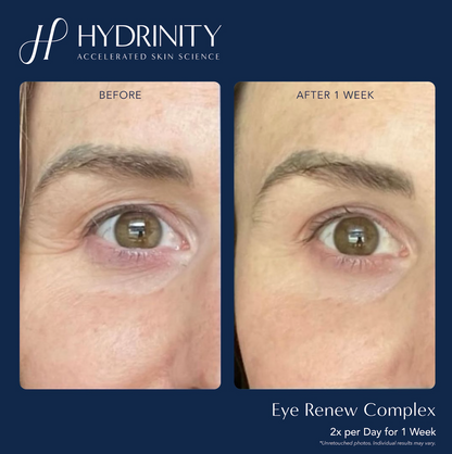 Eye Renewal Complex