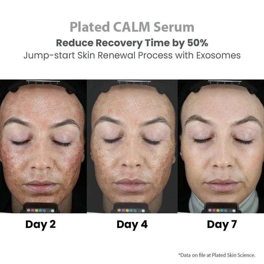 (plated) CALM Serum