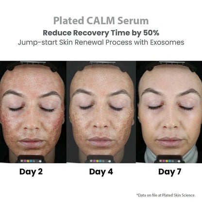 (plated) CALM Serum