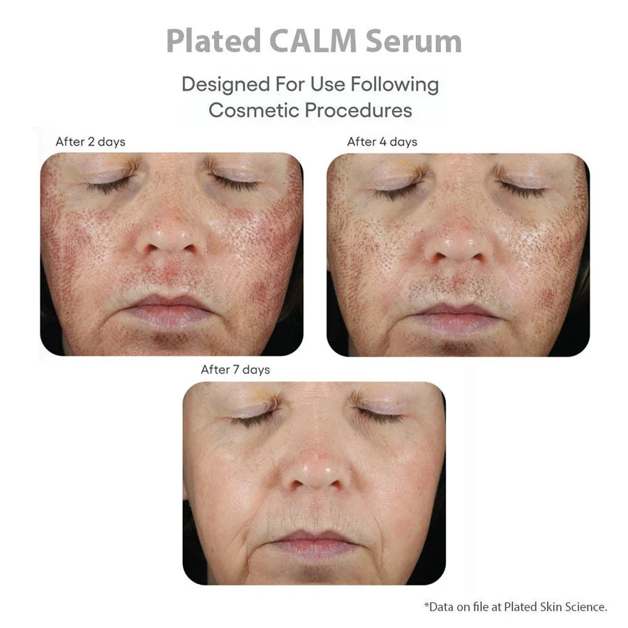 (plated) CALM Serum